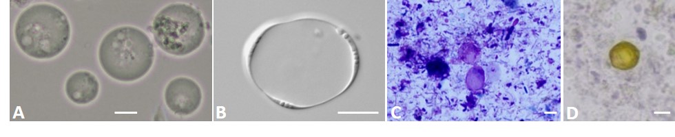 Blastocystis